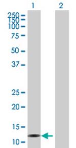 TANK Antibody in Western Blot (WB)