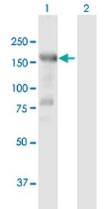 HDAC6 Antibody in Western Blot (WB)