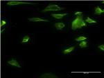 HDAC6 Antibody in Immunocytochemistry (ICC/IF)