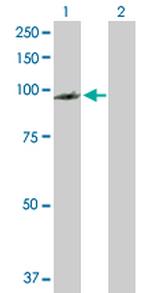 PDCD6IP Antibody in Western Blot (WB)