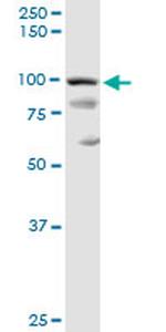 PDCD6IP Antibody in Western Blot (WB)