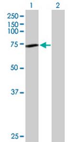 GNE Antibody in Western Blot (WB)