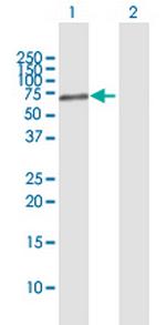 PARP3 Antibody in Western Blot (WB)