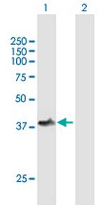 TOM1L1 Antibody in Western Blot (WB)