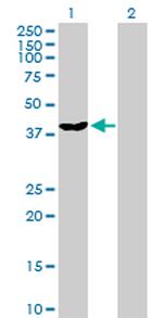 DNAJB6 Antibody in Western Blot (WB)