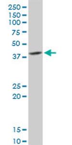 DNAJB6 Antibody in Western Blot (WB)