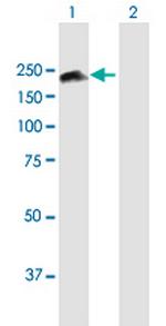 SMC4L1 Antibody in Western Blot (WB)