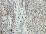 DNM1L Antibody in Immunohistochemistry (Paraffin) (IHC (P))