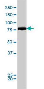 DNM1L Antibody in Western Blot (WB)