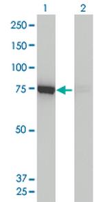 DNM1L Antibody in Western Blot (WB)