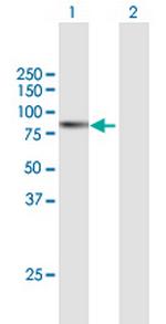 ABCF2 Antibody in Western Blot (WB)