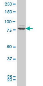 ZNF263 Antibody in Western Blot (WB)