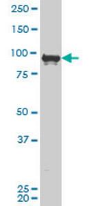 ZNF263 Antibody in Western Blot (WB)