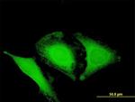 OPTN Antibody in Immunocytochemistry (ICC/IF)