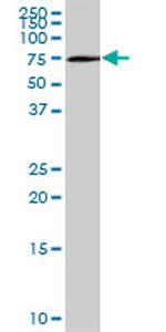 OPTN Antibody in Western Blot (WB)