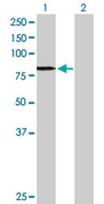 OPTN Antibody in Western Blot (WB)