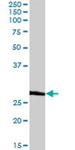 BCAP31 Antibody in Western Blot (WB)