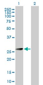 BCAP31 Antibody in Western Blot (WB)