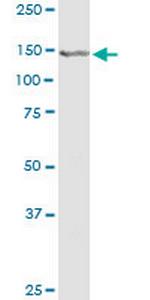 CEBPZ Antibody in Western Blot (WB)