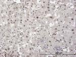 TRIM28 Antibody in Immunohistochemistry (Paraffin) (IHC (P))