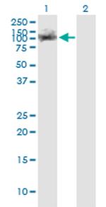 TRIM28 Antibody in Western Blot (WB)