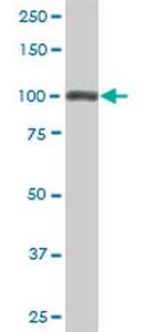 TRIM28 Antibody in Western Blot (WB)