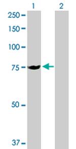 SLC25A13 Antibody in Western Blot (WB)