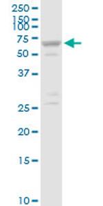 SLC25A13 Antibody in Western Blot (WB)