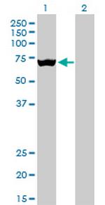 SLC25A13 Antibody in Western Blot (WB)