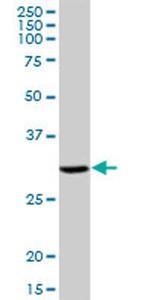 DHRS9 Antibody in Western Blot (WB)