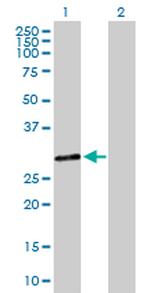 DHRS9 Antibody in Western Blot (WB)