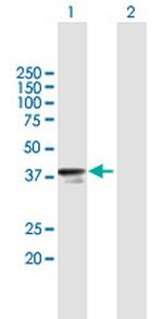 RNF41 Antibody in Western Blot (WB)