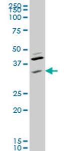 RNF41 Antibody in Western Blot (WB)