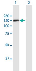 TSHZ1 Antibody in Western Blot (WB)