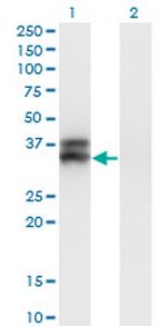 OLIG2 Antibody in Western Blot (WB)