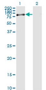 RASGRP2 Antibody in Western Blot (WB)