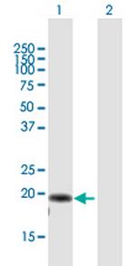 AP3S2 Antibody in Western Blot (WB)