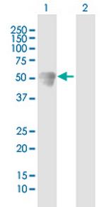 CALCOCO2 Antibody in Western Blot (WB)