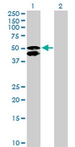 CALCOCO2 Antibody in Western Blot (WB)