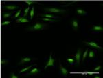 CALCOCO2 Antibody in Immunocytochemistry (ICC/IF)