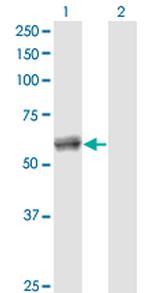 CALCOCO2 Antibody in Western Blot (WB)