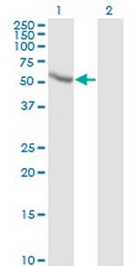 CALCOCO2 Antibody in Western Blot (WB)