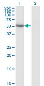 CALCOCO2 Antibody in Western Blot (WB)