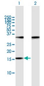 POP7 Antibody in Western Blot (WB)