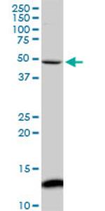 IRX5 Antibody in Western Blot (WB)