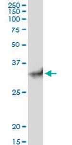 STUB1 Antibody in Western Blot (WB)