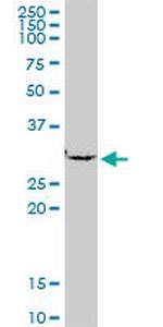 SMNDC1 Antibody in Western Blot (WB)