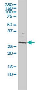 SMNDC1 Antibody in Western Blot (WB)