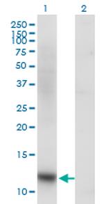 SNAPC5 Antibody in Western Blot (WB)