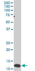 SNAPC5 Antibody in Western Blot (WB)